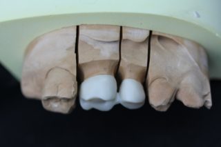 G-2 CCZ ARMATURES ZIRCONE